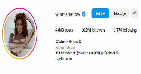 (@winnieharlow) Instagram famous girl